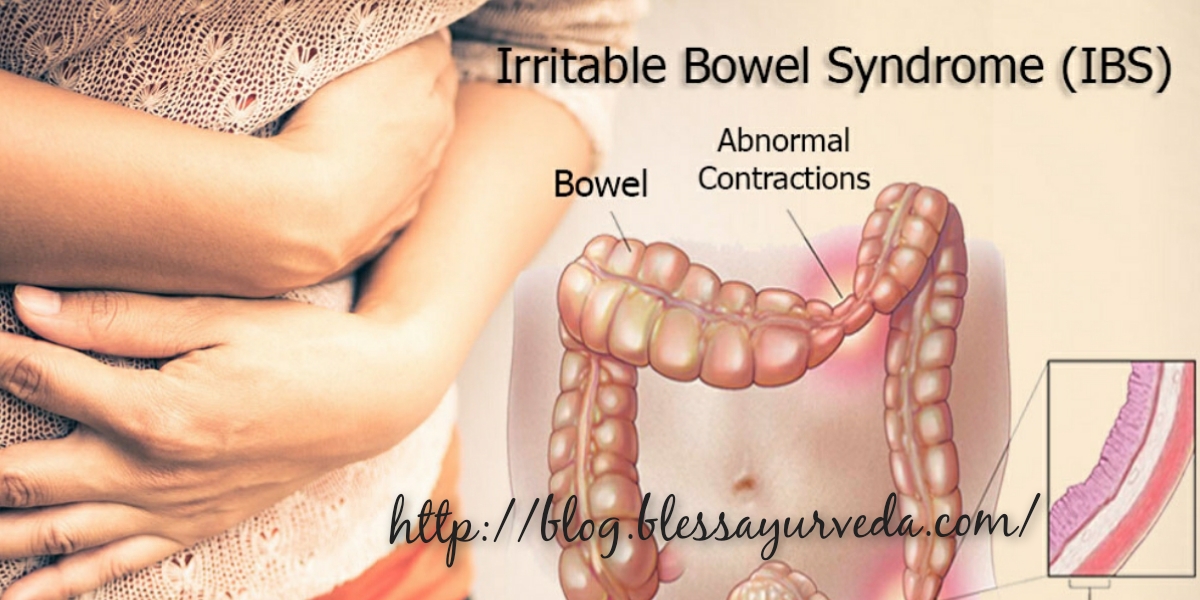 IBS Ayurvedic Treatment, Home Remedies, Lifestyle Tips